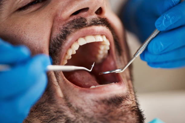 Best Cracked Tooth Emergency Dentist  in Rio Vista, TX