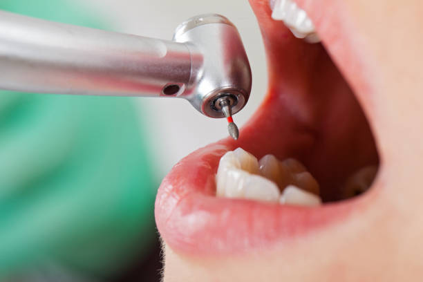 Best Teeth Whitening  in Rio Vista, TX